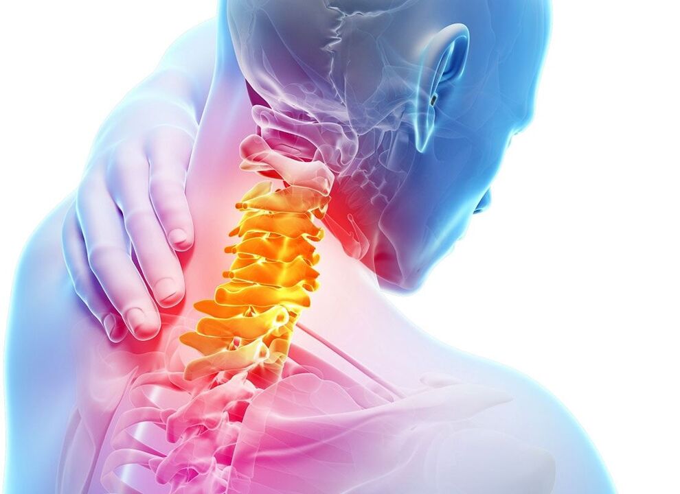 Lokalisierung der Osteochondrose